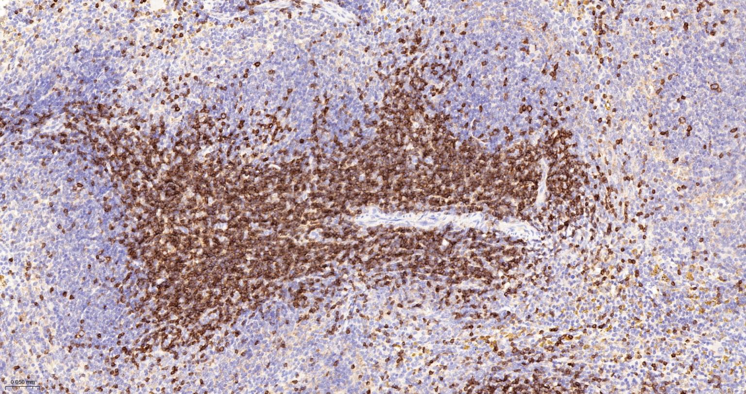 CD3/CD3-ε重组兔单抗