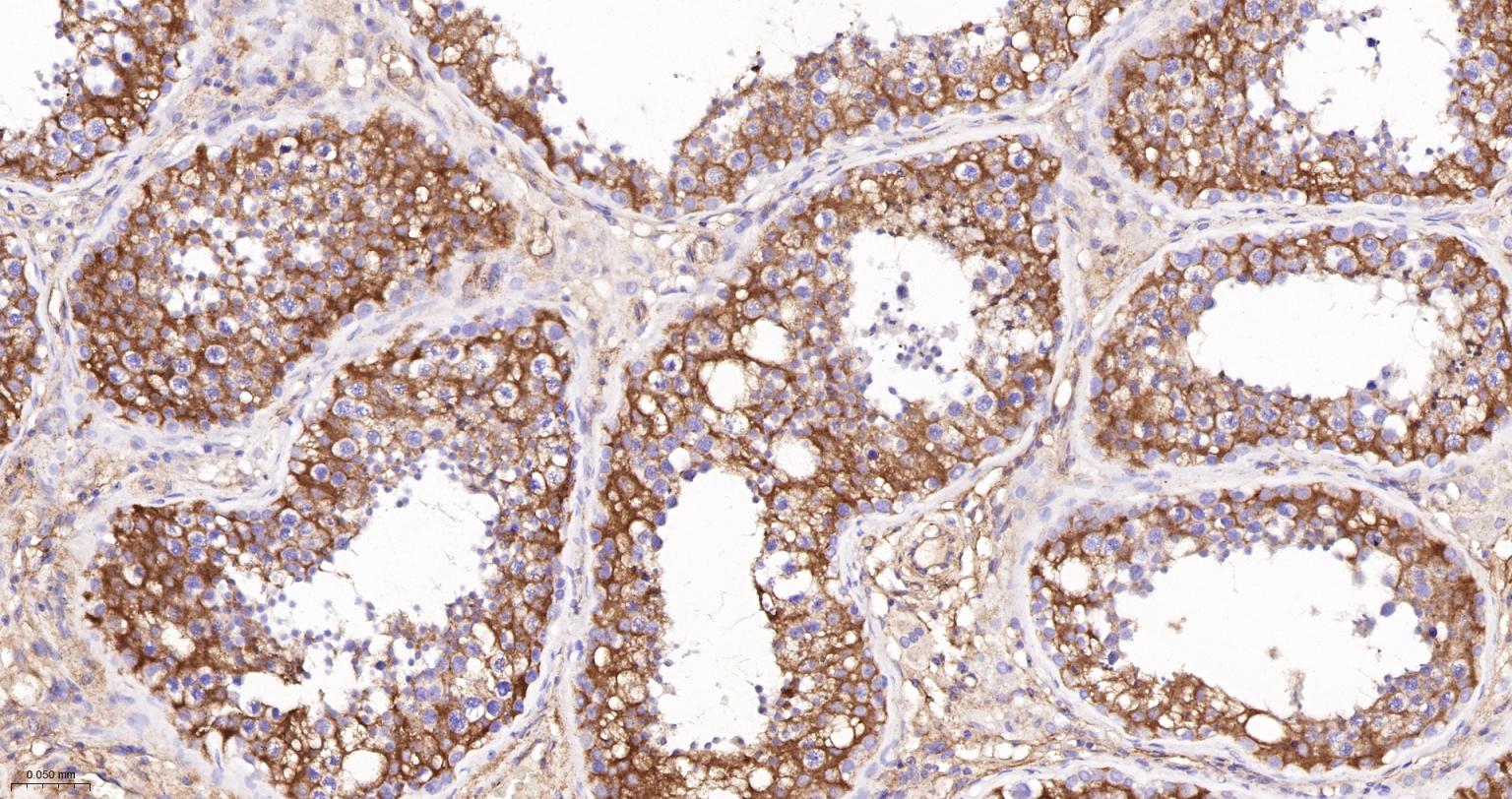 粘着斑蛋白（内参）重组兔单抗