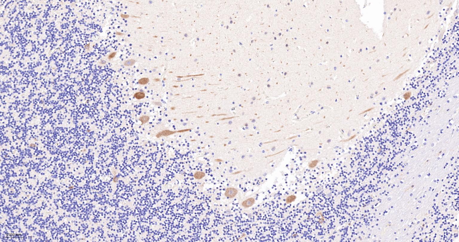 丝氨酸/苏氨酸蛋白激酶DCAMKL1重组兔单抗