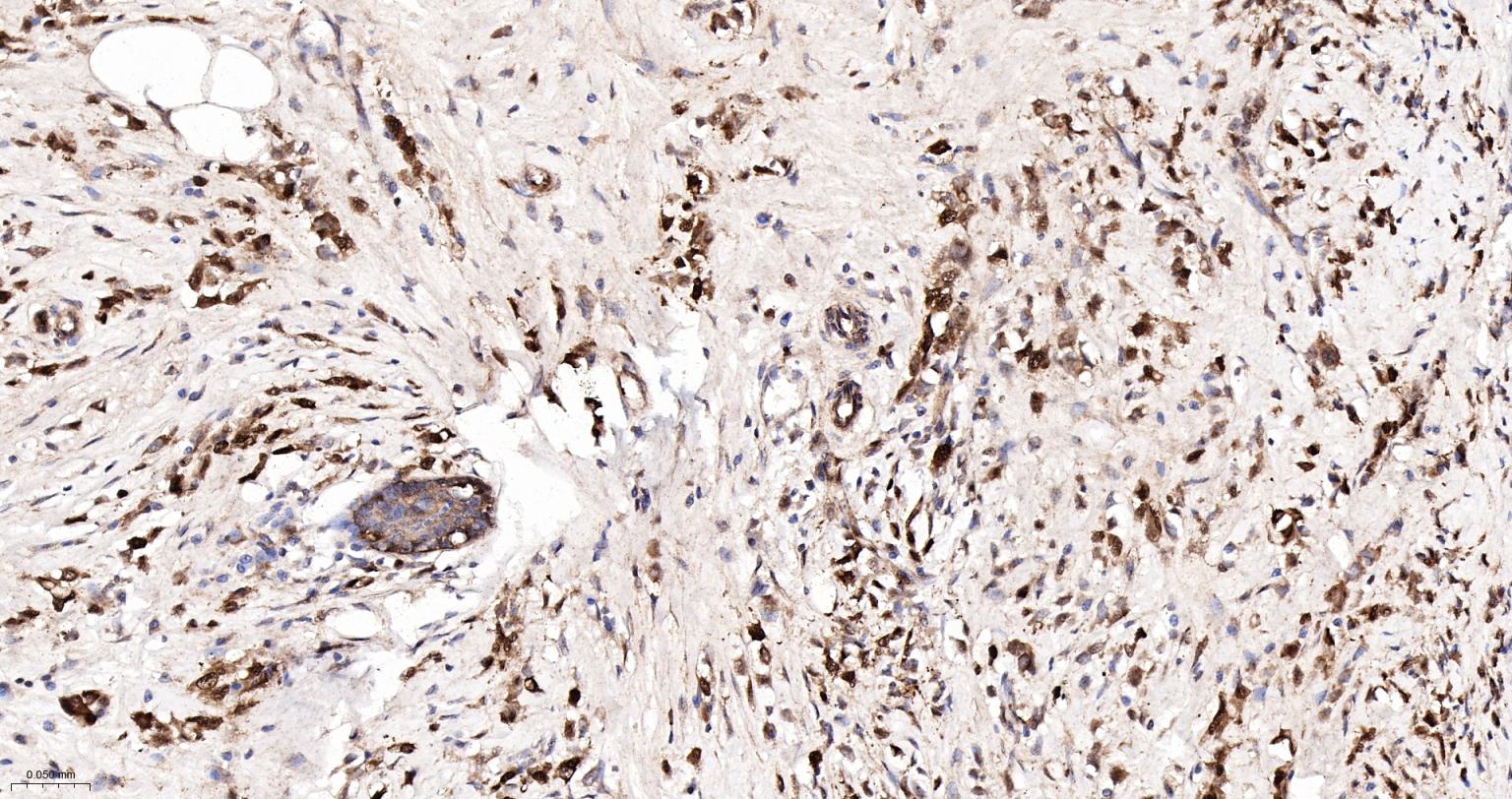 白血病相关蛋白18/癌蛋白18重组兔单抗