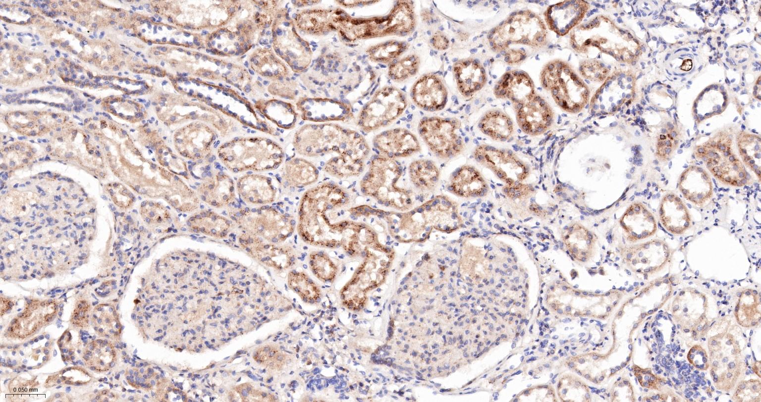 组织蛋白酶B重组兔单抗