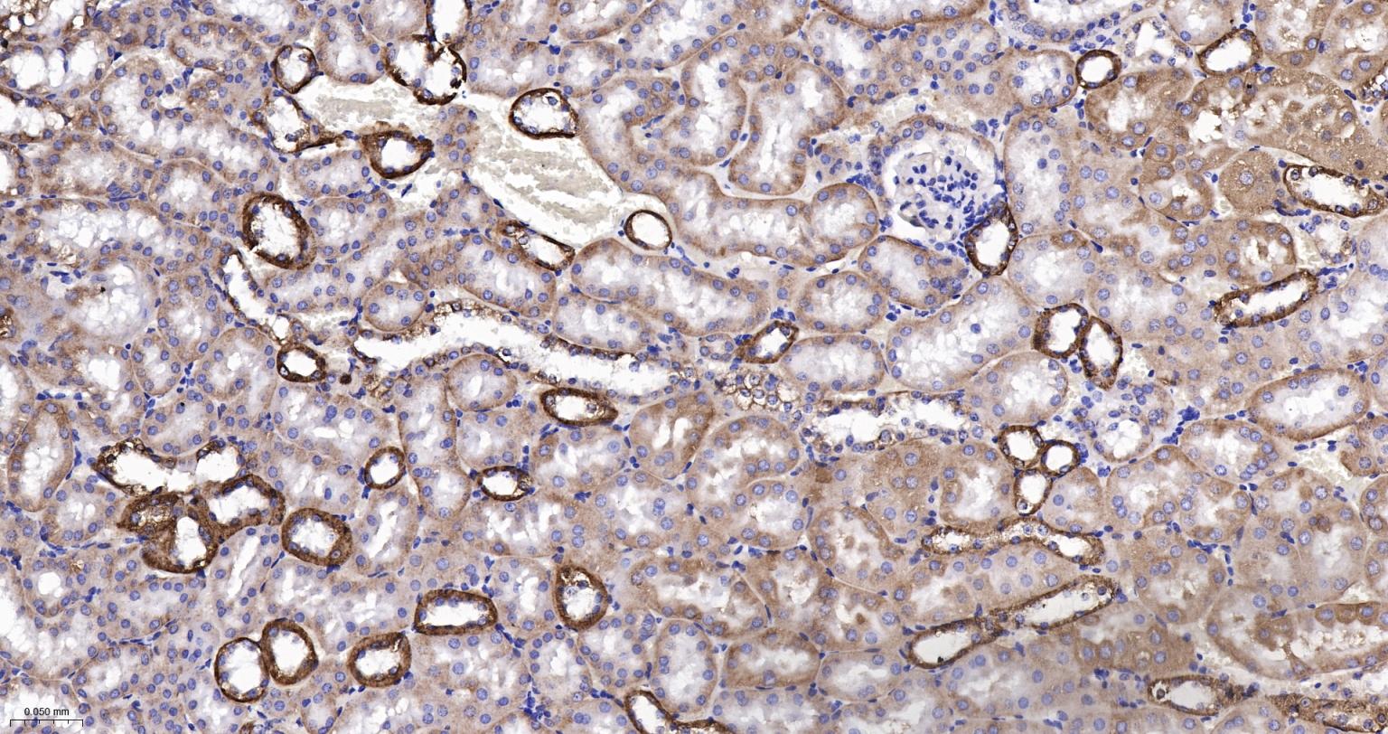 细胞色素P450 2D6重组兔单抗-bsm-61641R