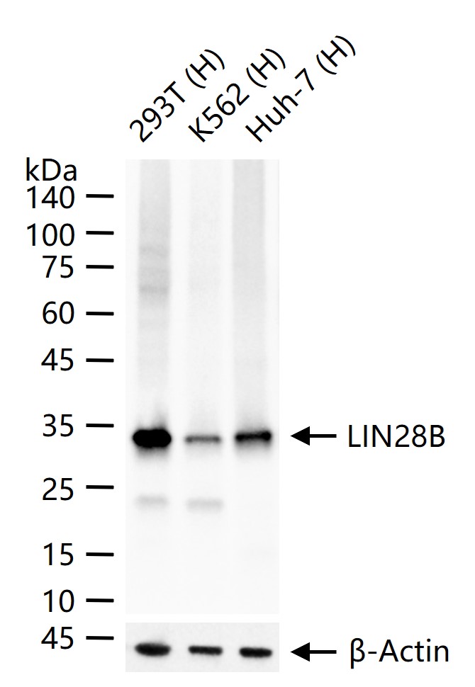 RNA结合蛋白LIN28B重组兔单抗