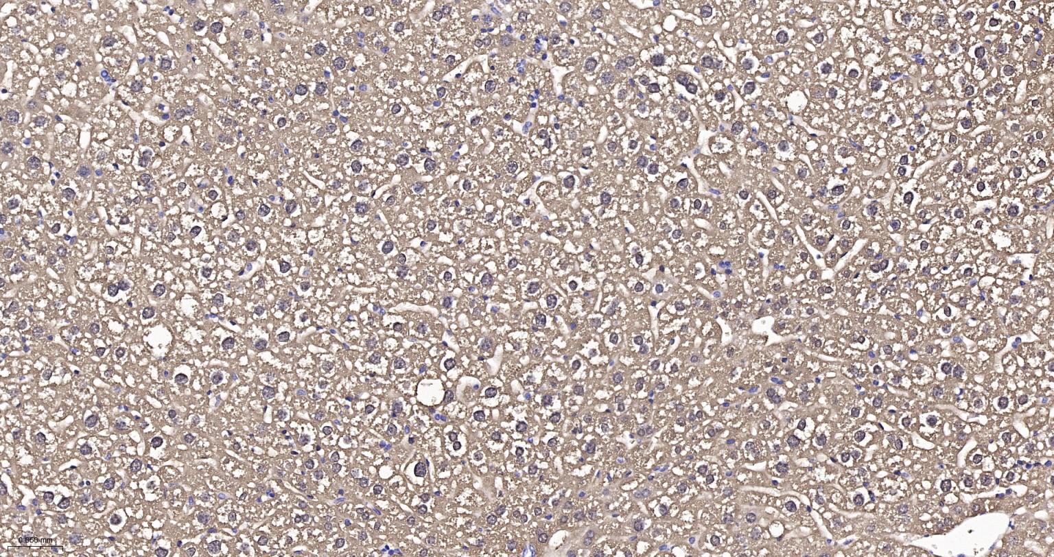 果糖1，6-二磷酸酯酶重组兔单抗