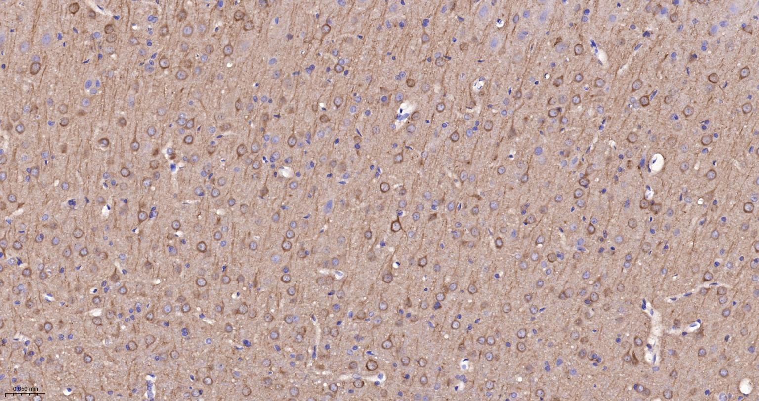 丝氨酸/苏氨酸蛋白激酶DCAMKL1重组兔单抗