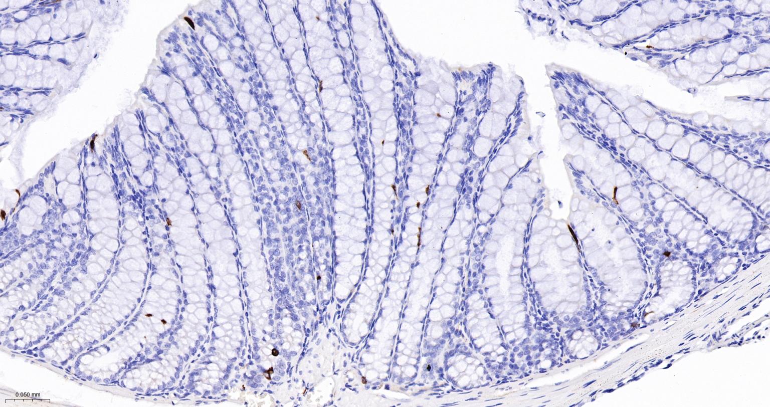 丝氨酸/苏氨酸蛋白激酶DCAMKL1重组兔单抗
