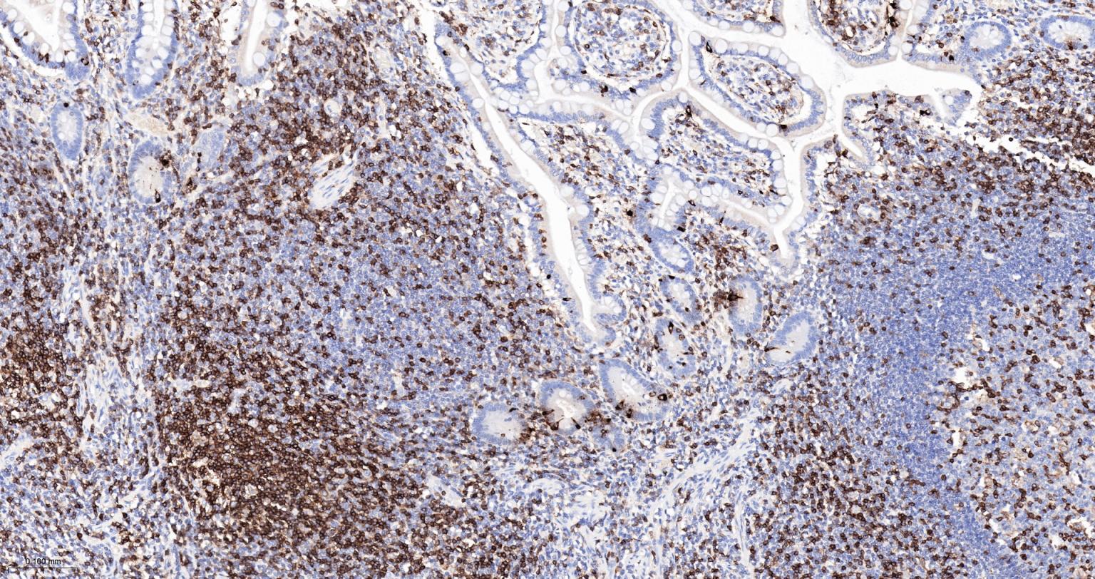 CD3/CD3-ε重组兔单抗