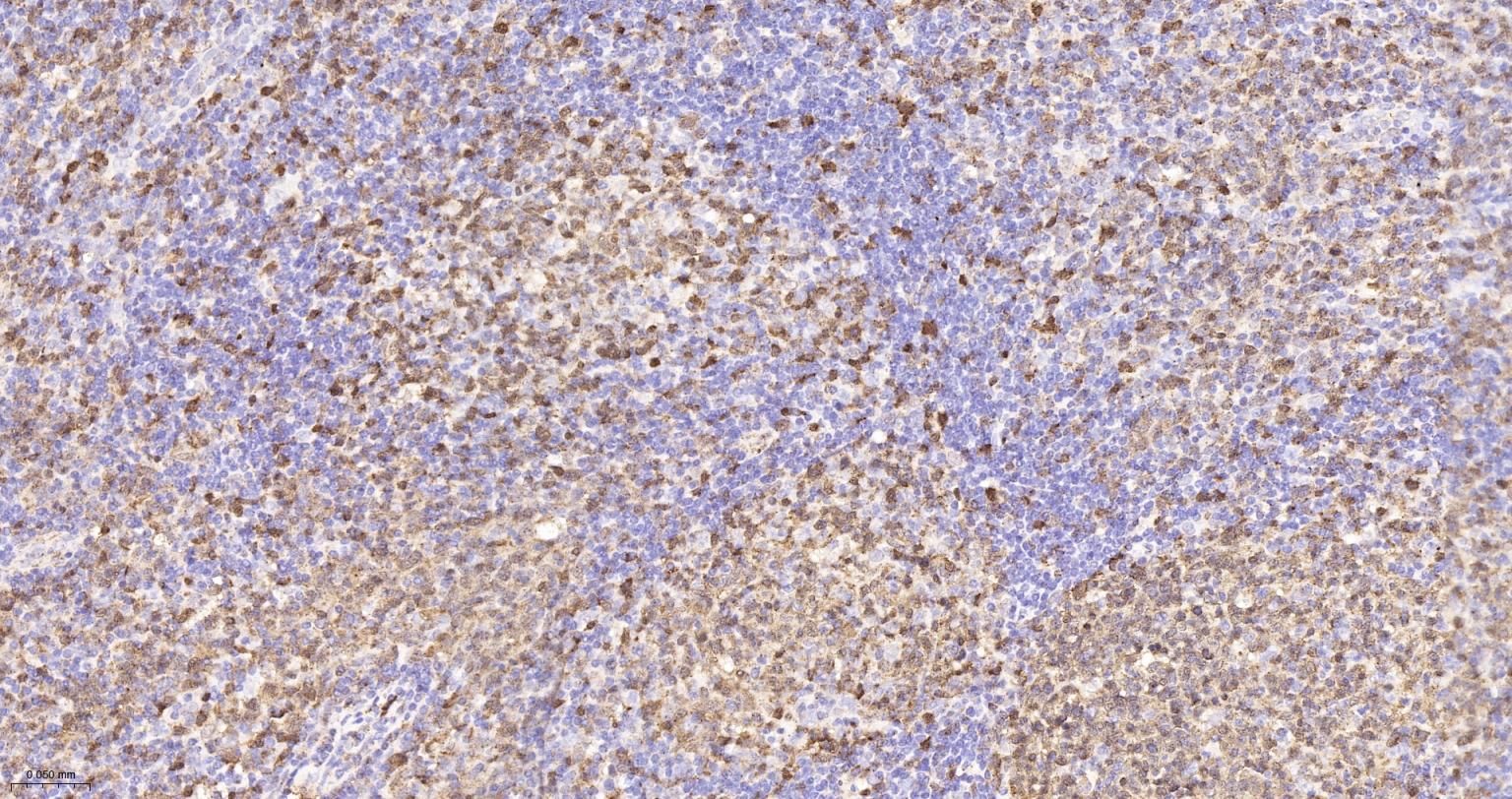 白血病相关蛋白18/癌蛋白18重组兔单抗