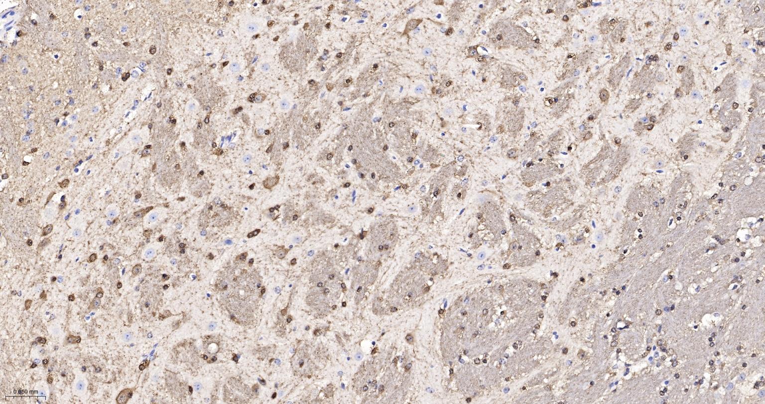 白血病相关蛋白18/癌蛋白18重组兔单抗