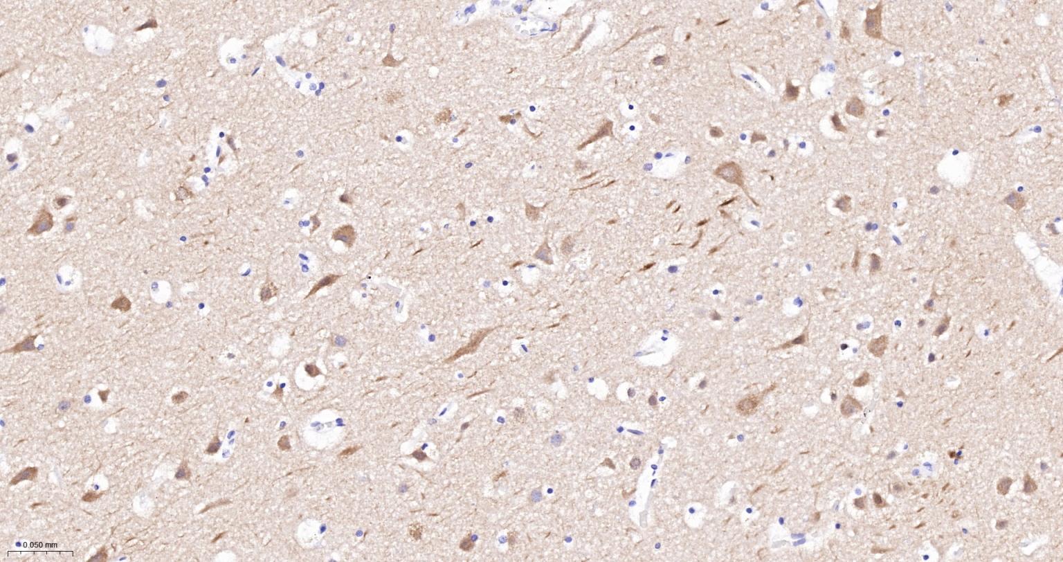 丝氨酸/苏氨酸蛋白激酶DCAMKL1重组兔单抗