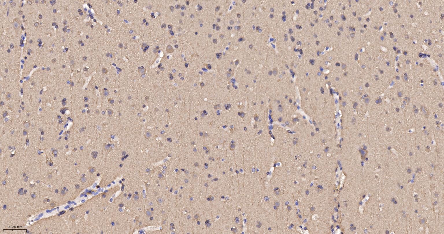 自噬微管相关蛋白轻链3重组兔单抗