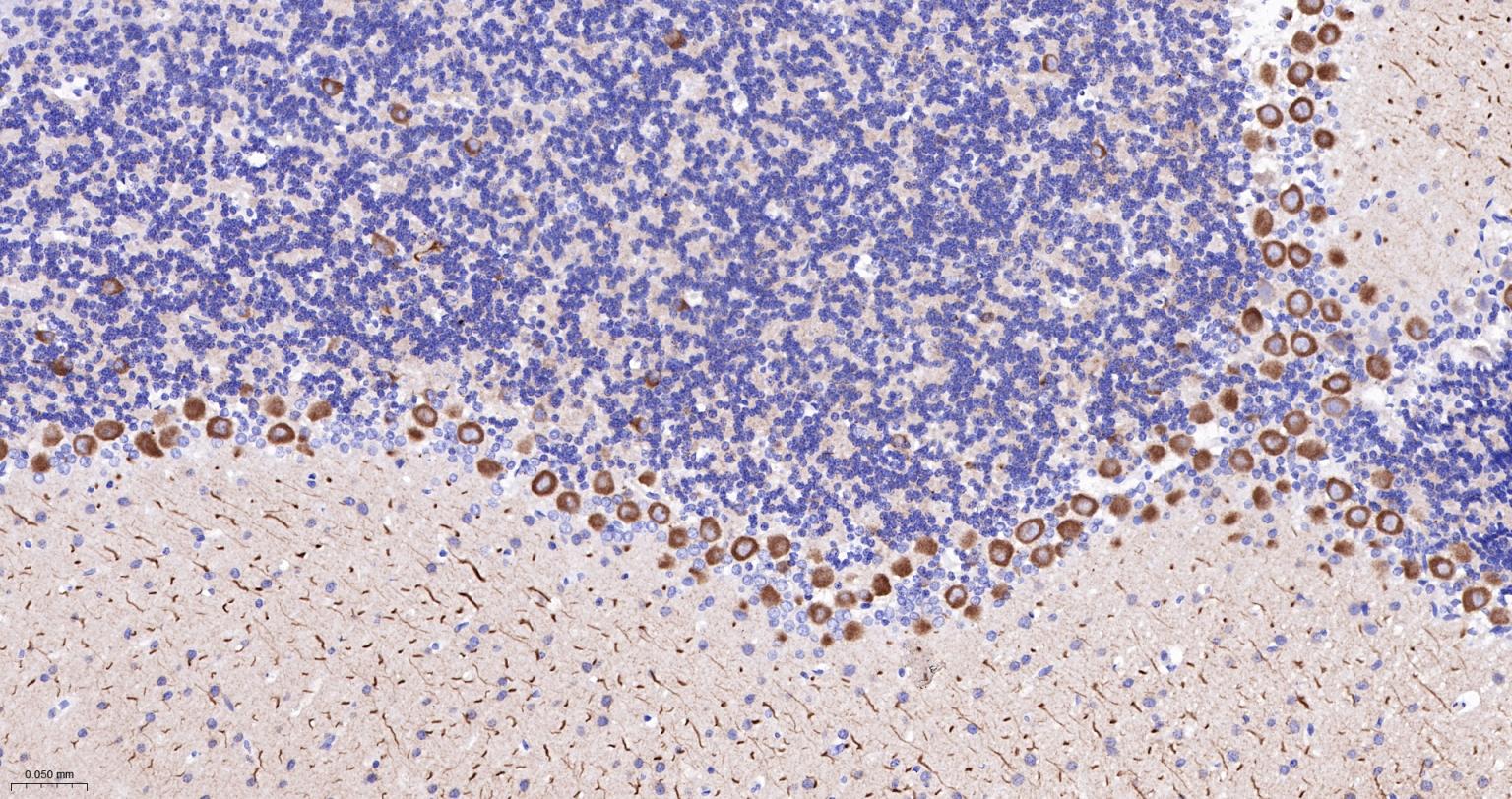 丝氨酸/苏氨酸蛋白激酶DCAMKL1重组兔单抗