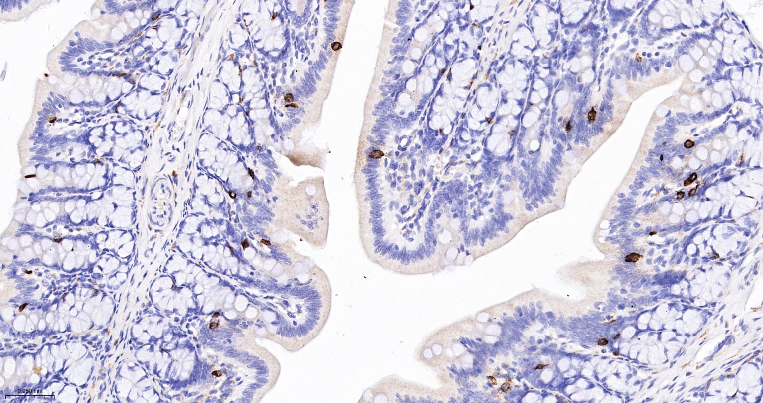 丝氨酸/苏氨酸蛋白激酶DCAMKL1重组兔单抗