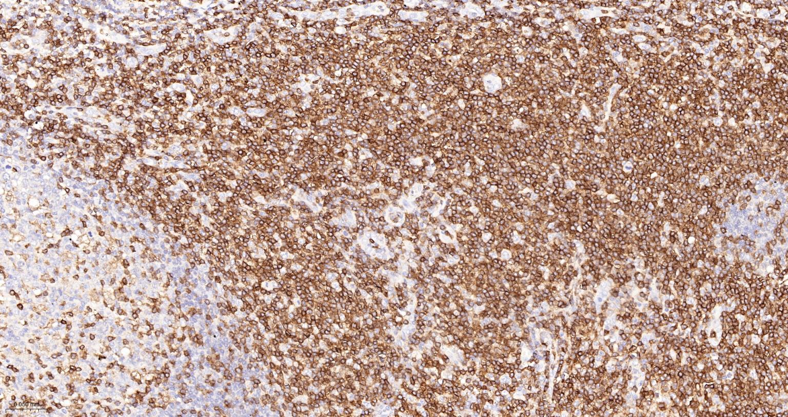 CD3/CD3-ε重组兔单抗