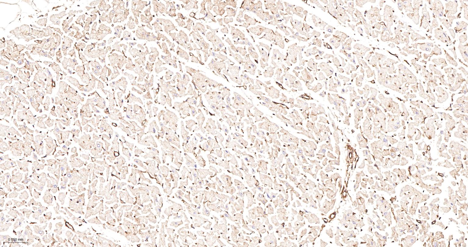 粘着斑蛋白（内参）重组兔单抗