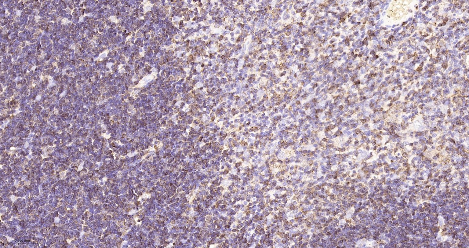 白血病相关蛋白18/癌蛋白18重组兔单抗