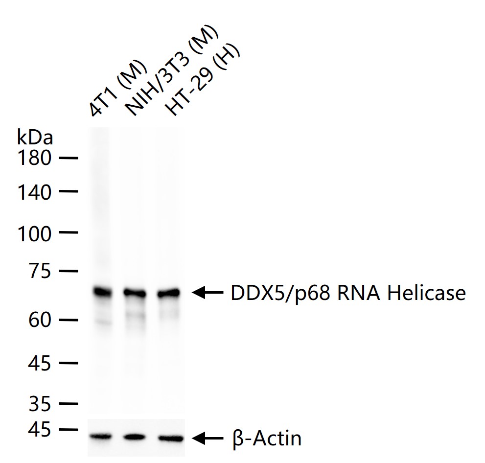 DDX5/p68 RNA Helicase Recombinant Rabbit mAb (一抗) - WB,IHC-P,IHC-F,IF,Flow-Cyt,ICC/IF,IP | Bioss