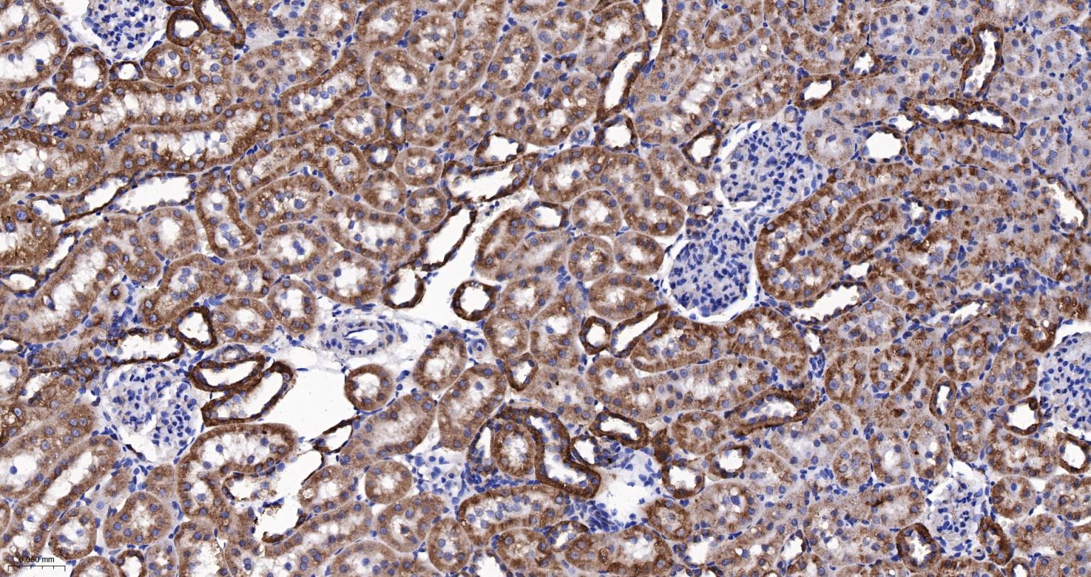 细胞色素P450 2D6重组兔单抗-bsm-61641R