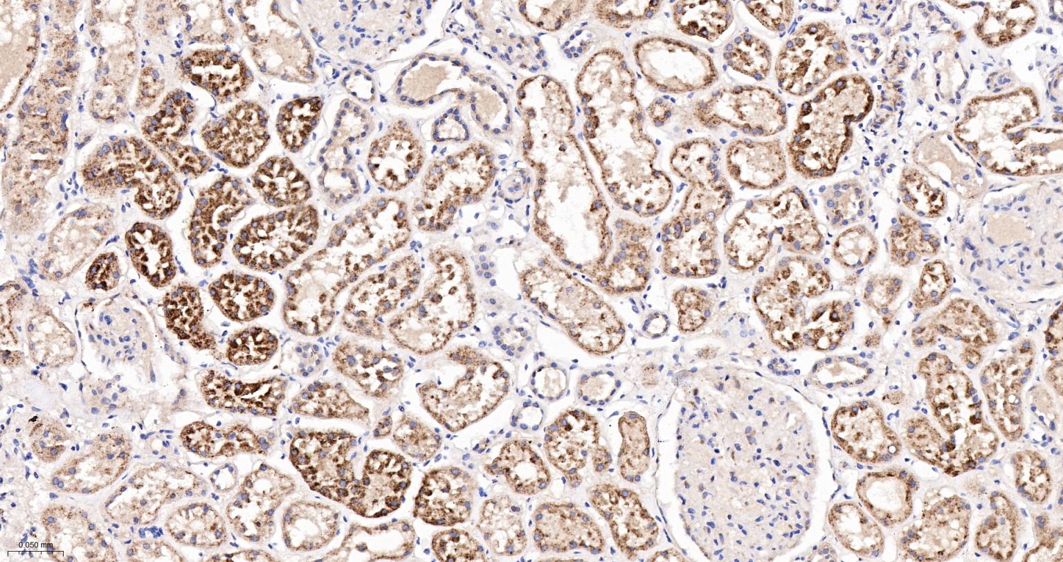 溶酶体相关膜蛋白2（CD107B）重组兔单抗