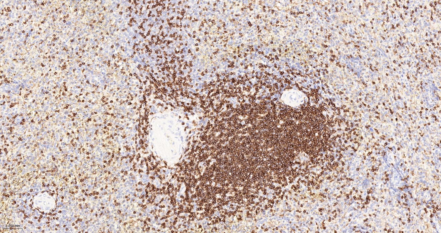 CD3/CD3-ε重组兔单抗