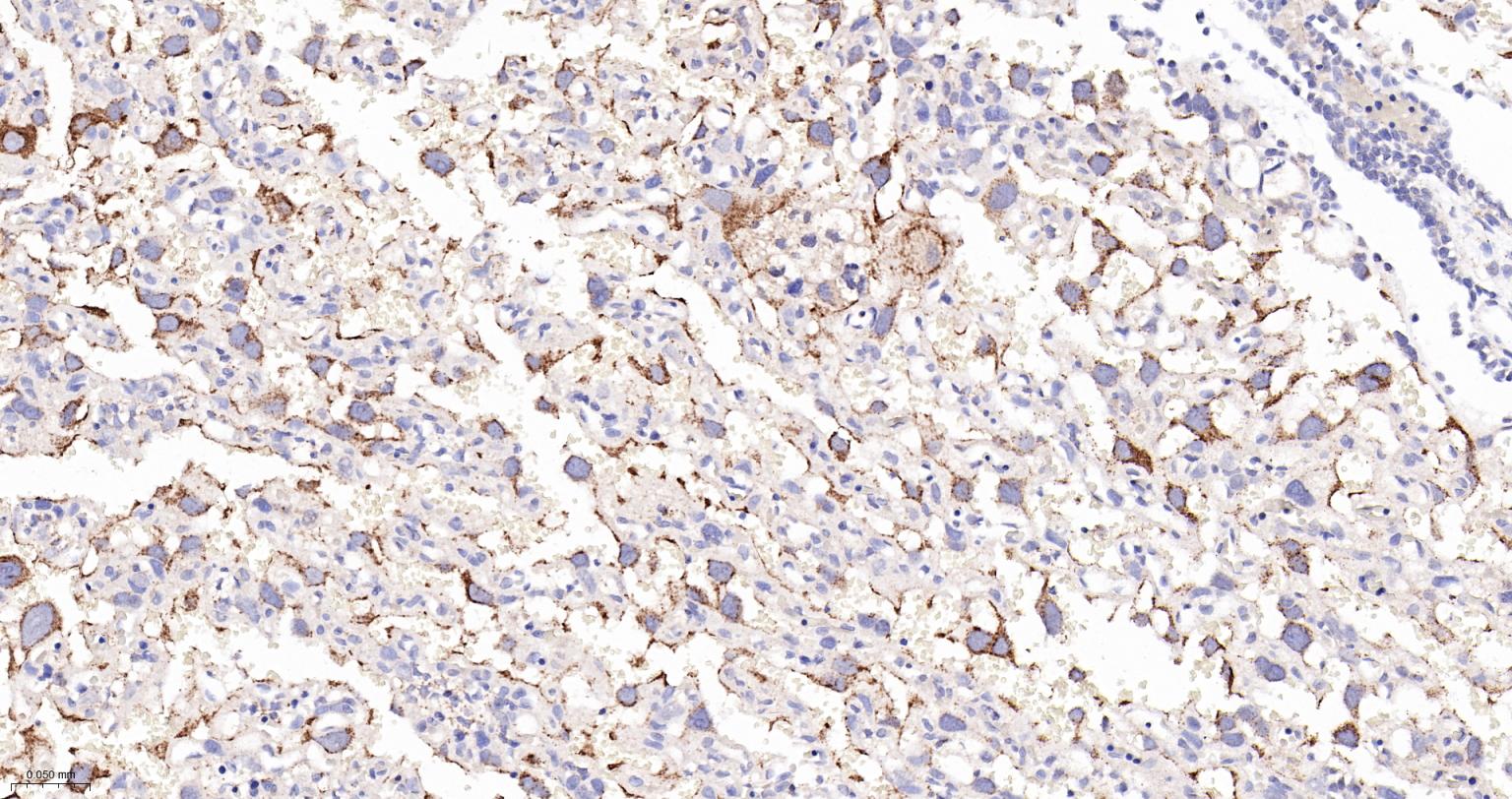 溶酶体相关膜蛋白2（CD107B）重组兔单抗