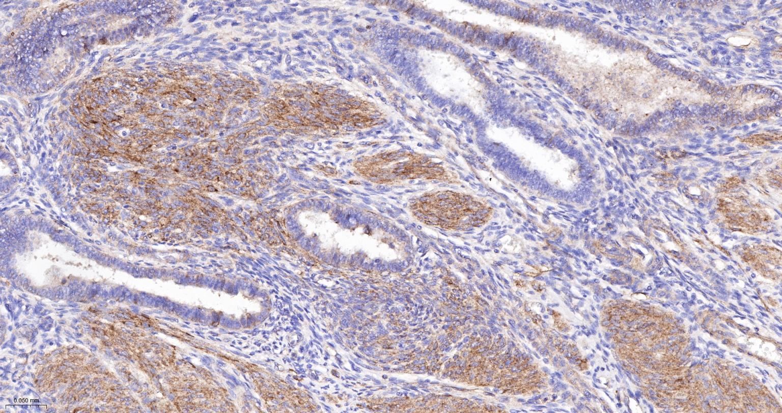 粘着斑蛋白（内参）重组兔单抗