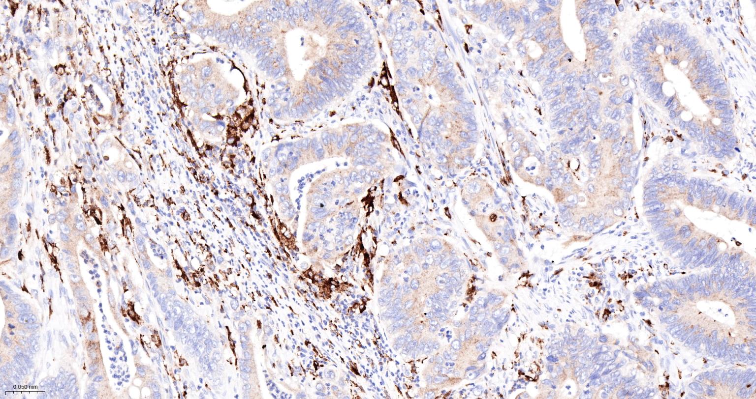 组织蛋白酶B重组兔单抗