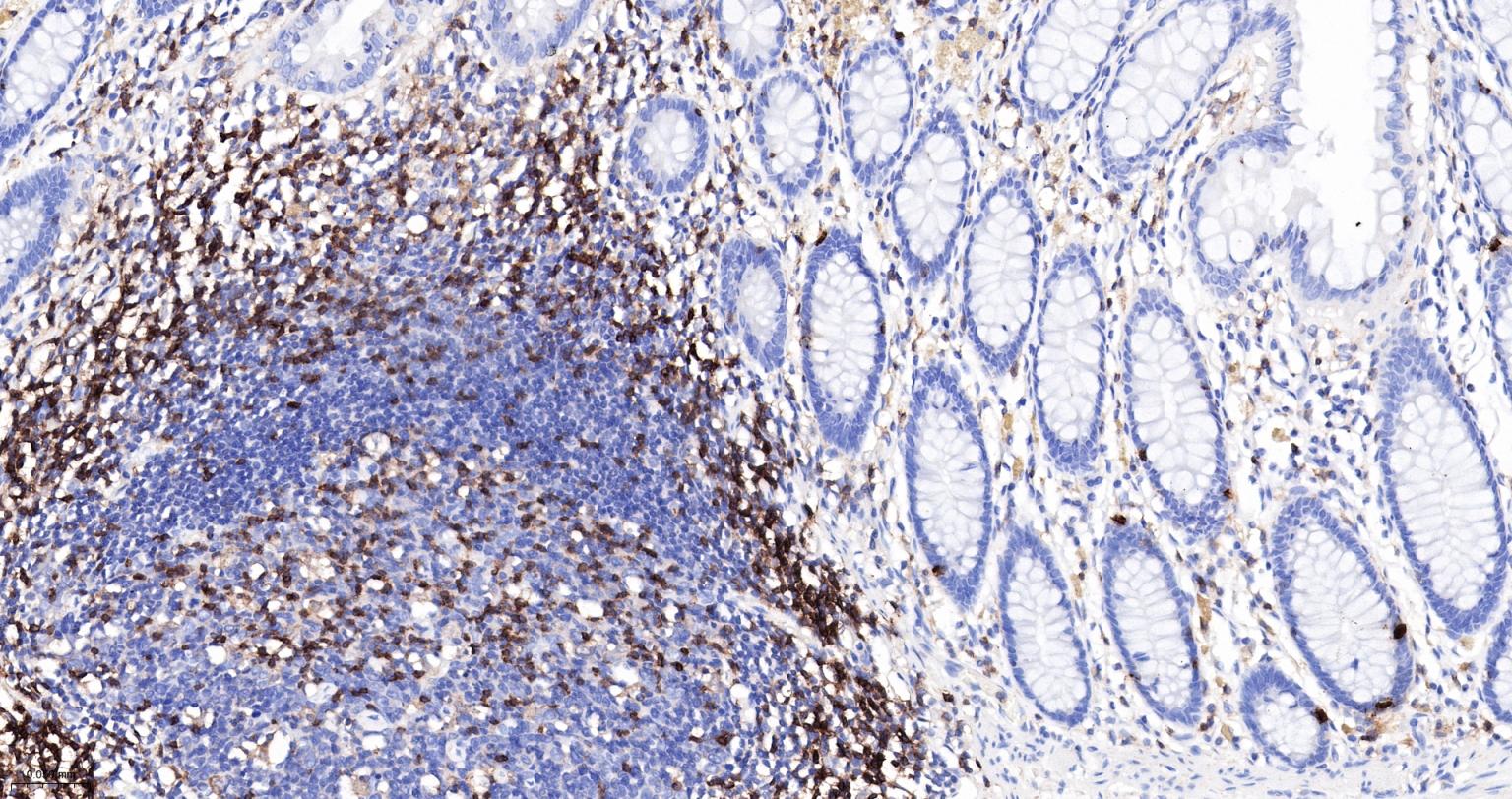 CD3/CD3-ε重组兔单抗