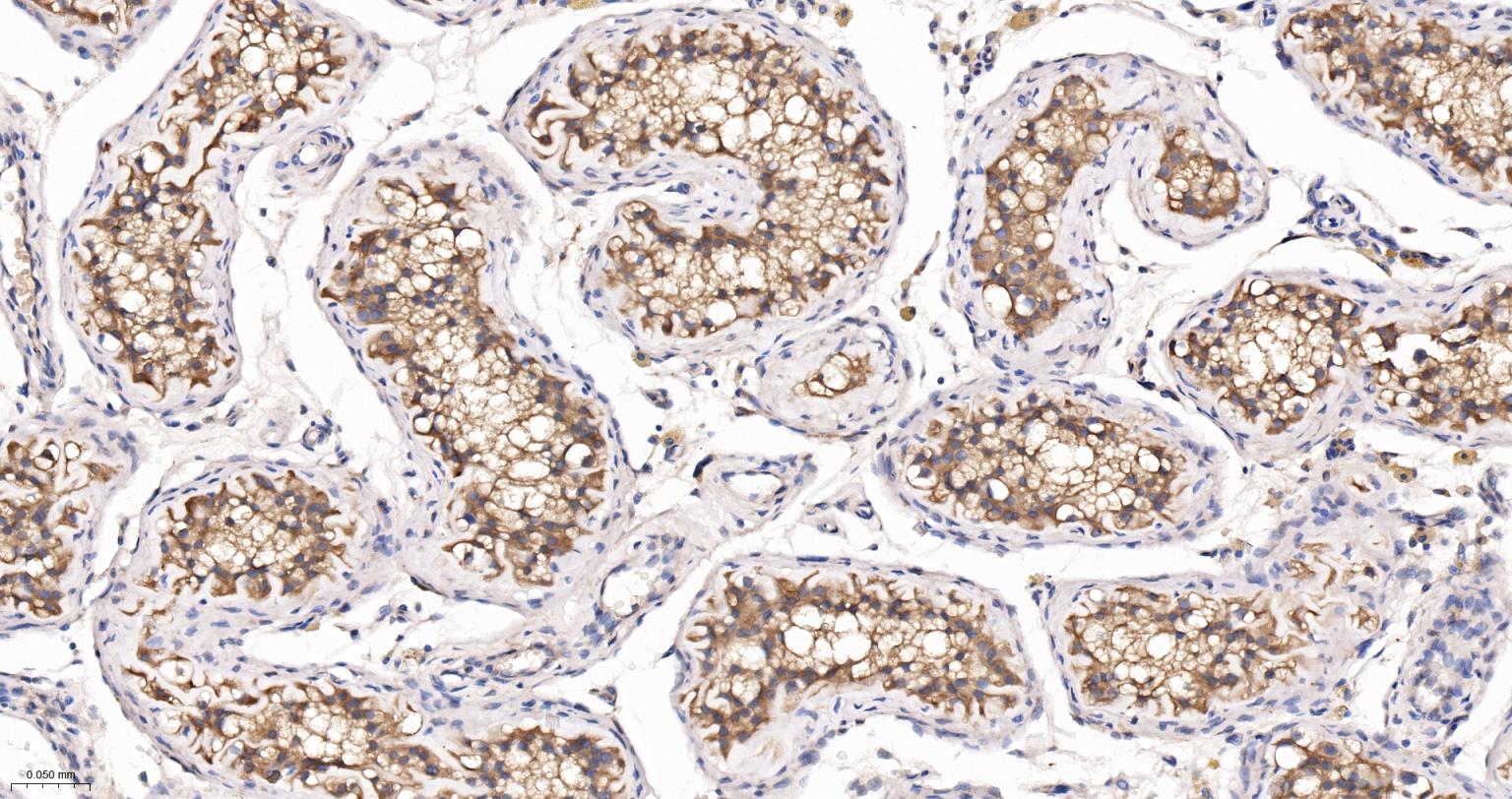 自噬微管相关蛋白轻链3重组兔单抗