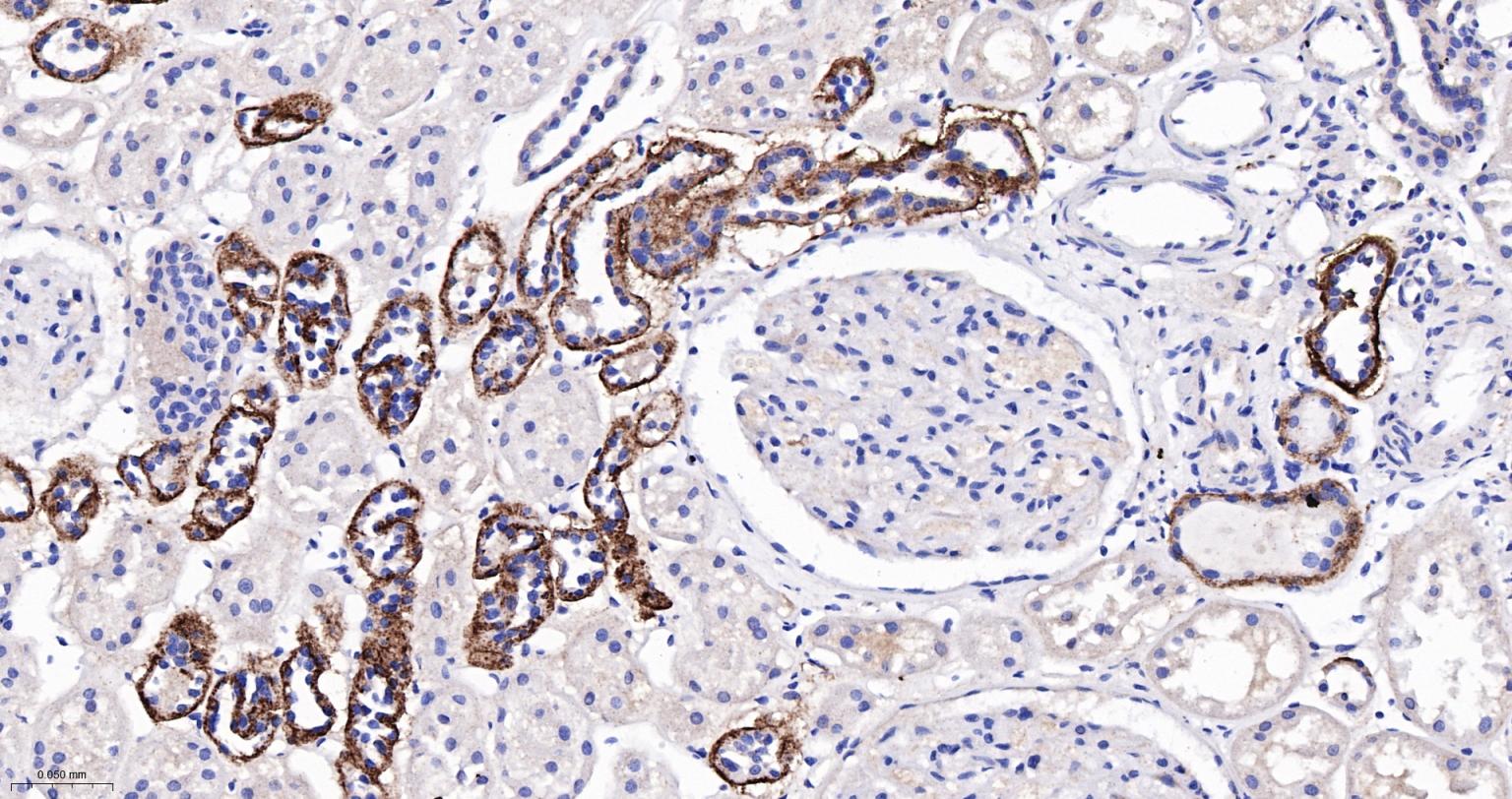 细胞色素P450 2D6重组兔单抗-bsm-61641R