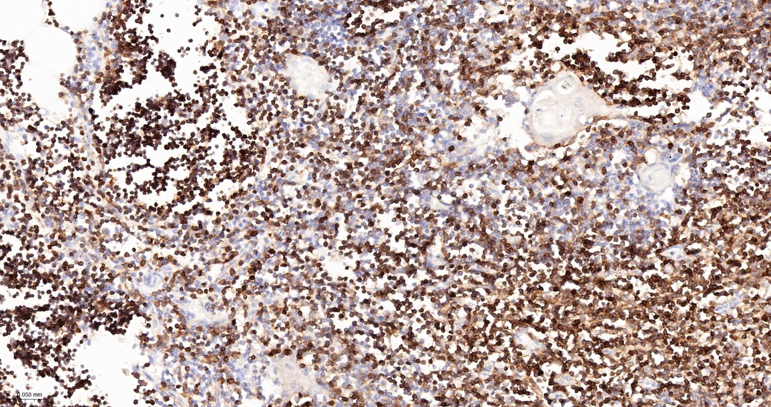 CD3/CD3-ε重组兔单抗