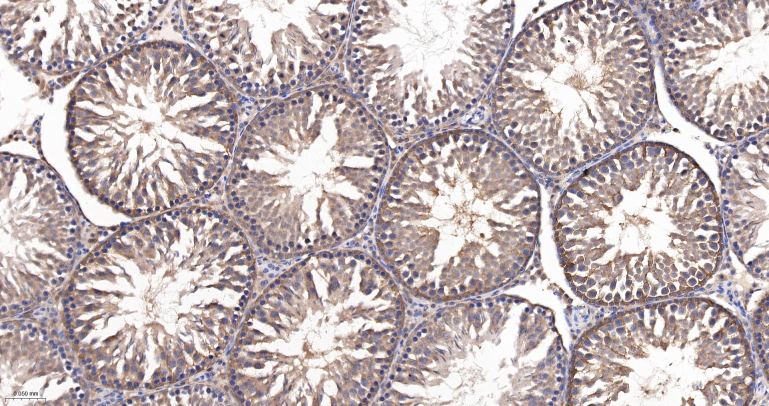 自噬微管相关蛋白轻链3重组兔单抗