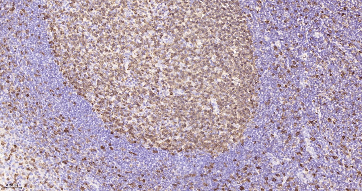 白血病相关蛋白18/癌蛋白18重组兔单抗