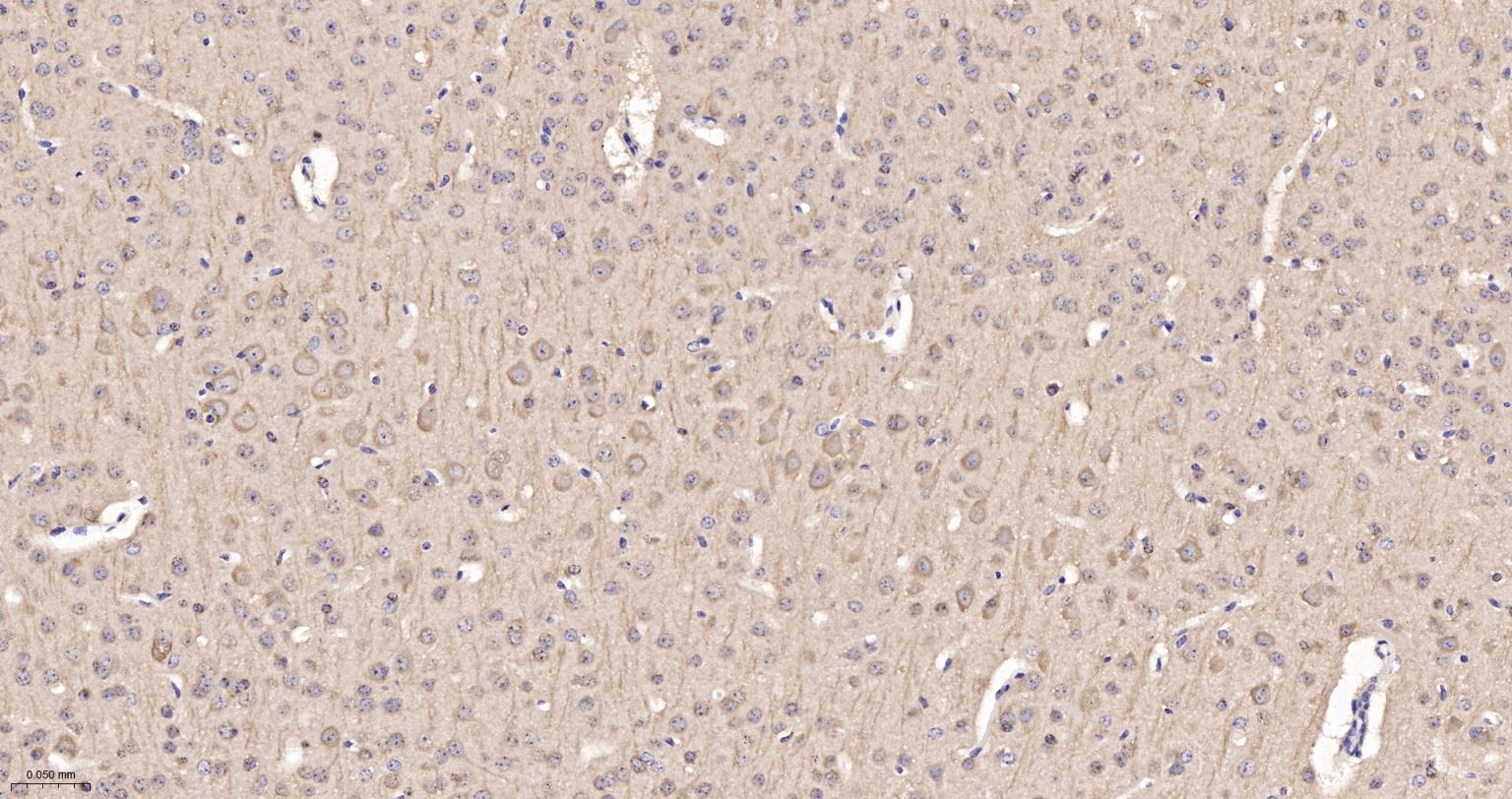 自噬微管相关蛋白轻链3重组兔单抗