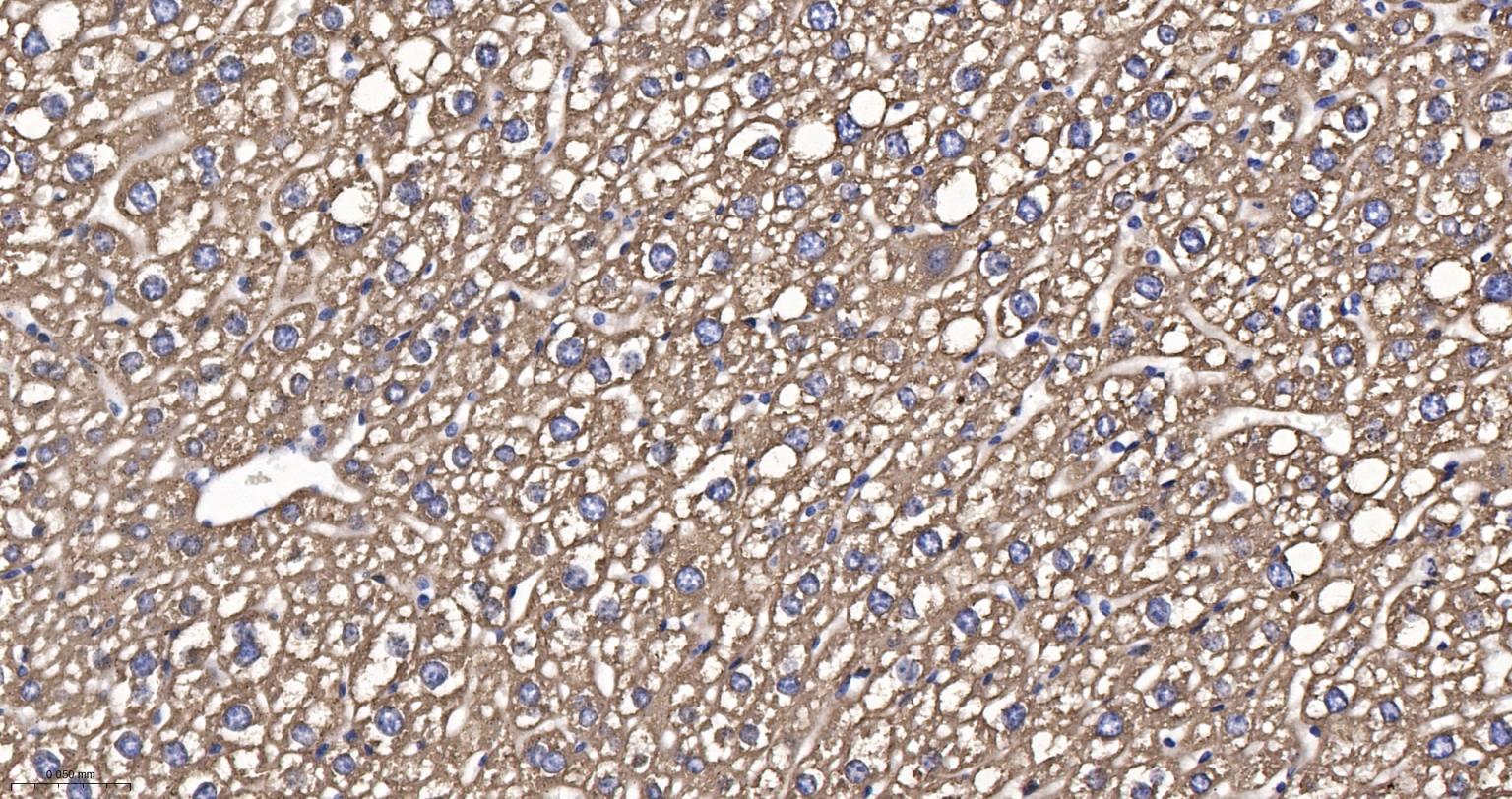 细胞色素P450 2D6重组兔单抗-bsm-61641R