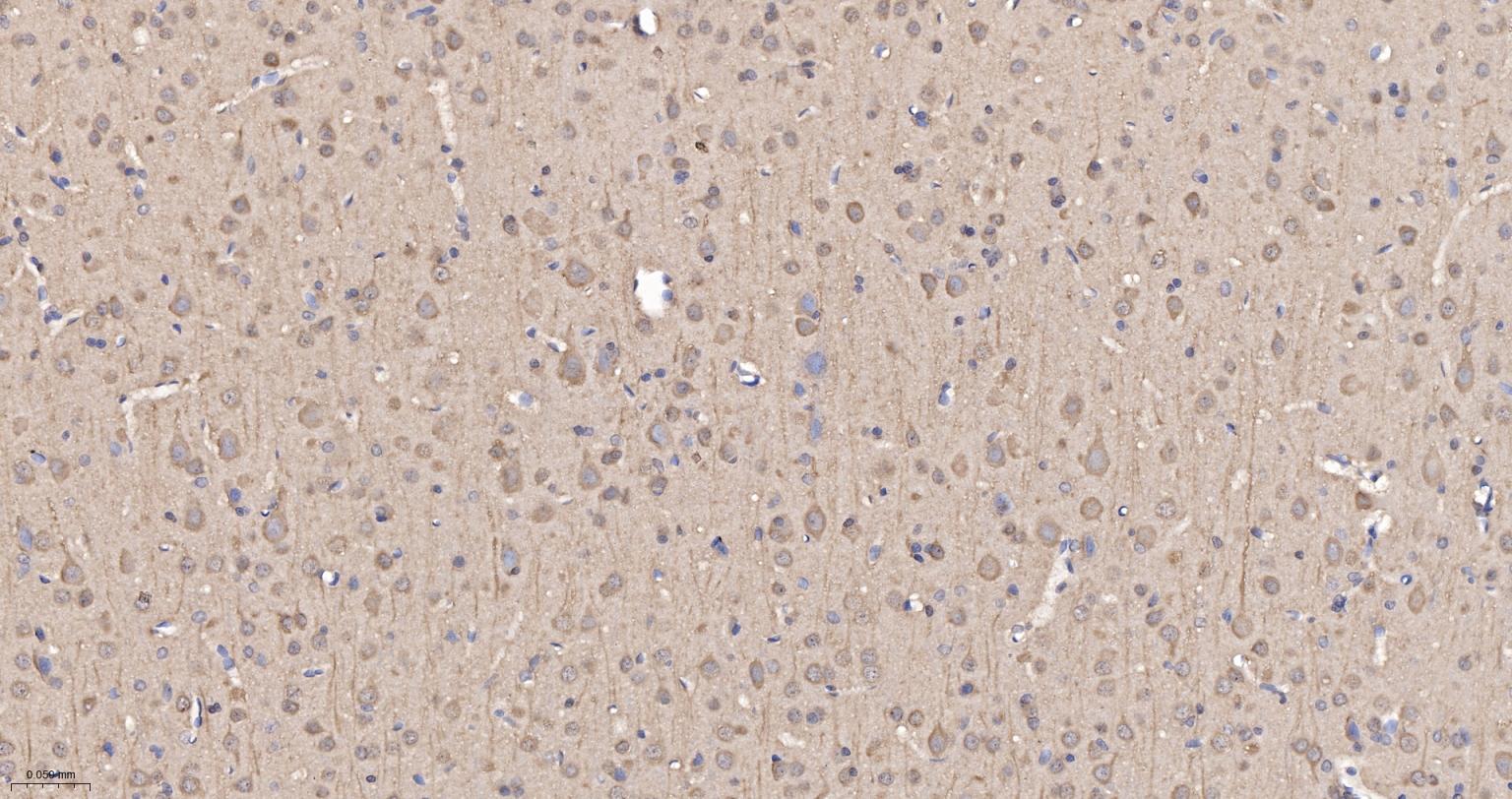 自噬微管相关蛋白轻链3重组兔单抗