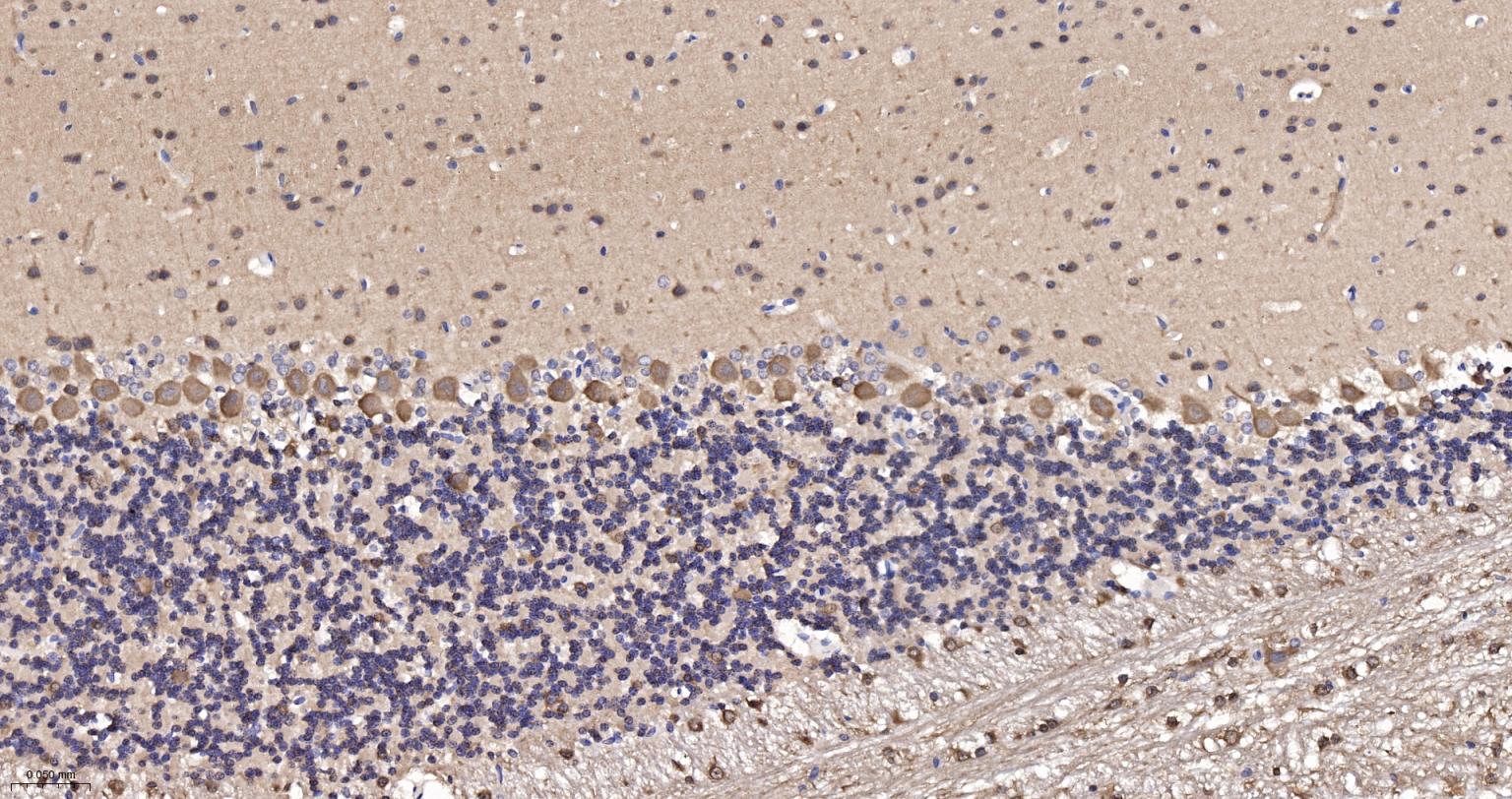 自噬微管相关蛋白轻链3重组兔单抗