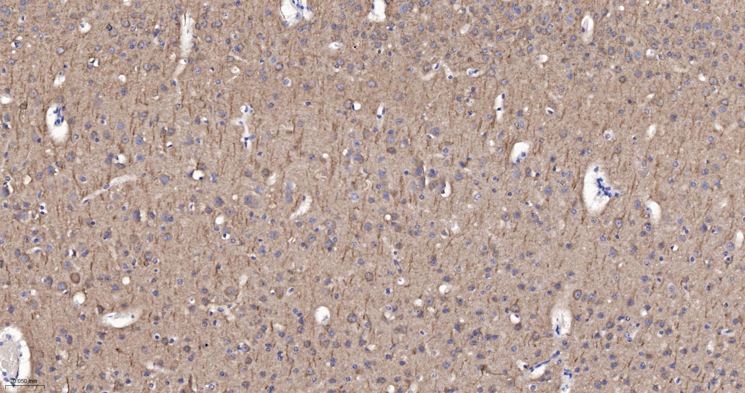 丝氨酸/苏氨酸蛋白激酶DCAMKL1重组兔单抗