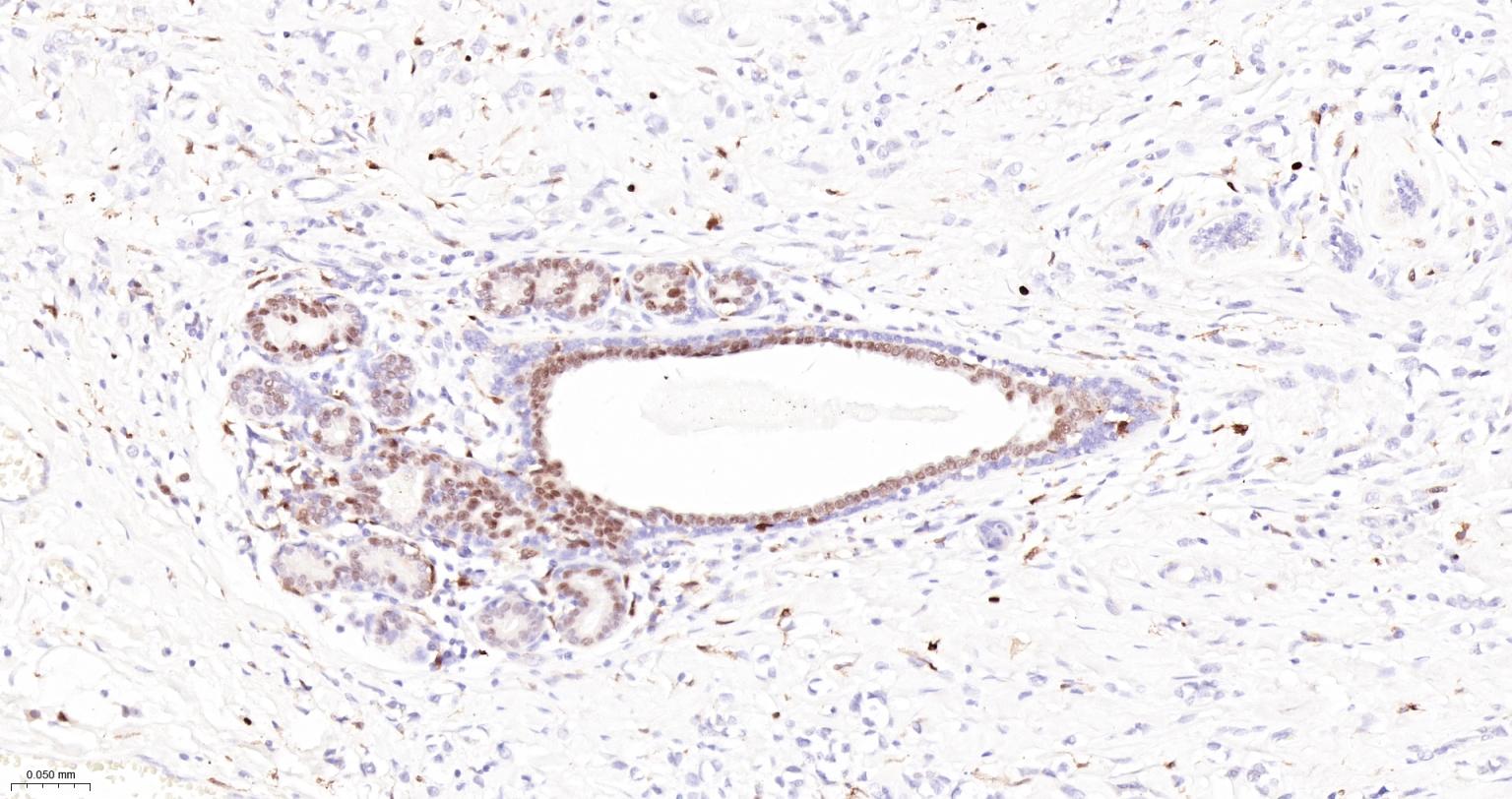 5-脂氧合酶重组兔单抗