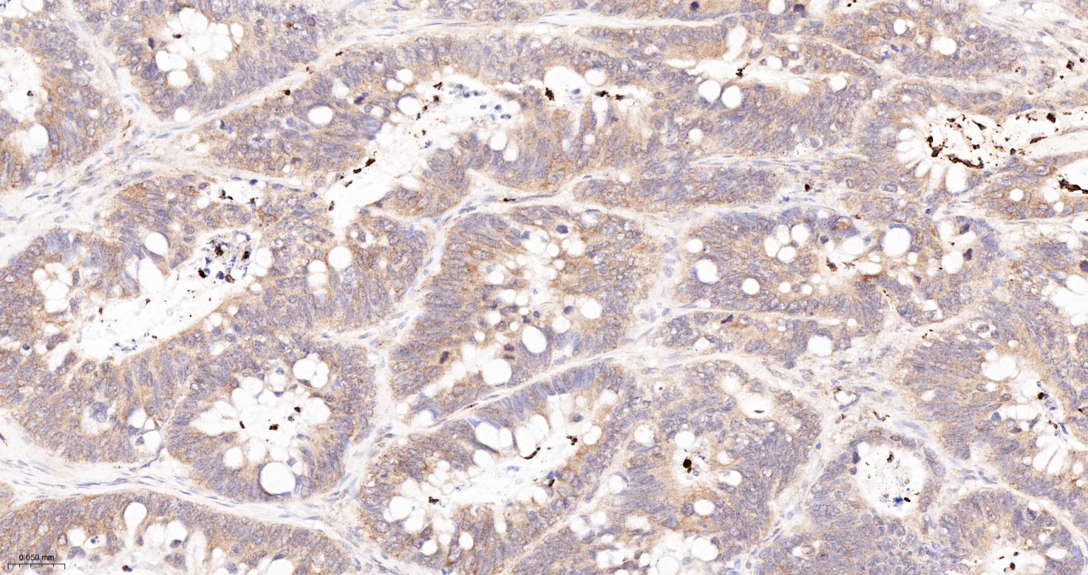 Ras GTP酶活化蛋白结合蛋白1重组兔单抗