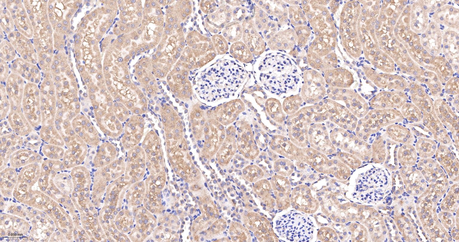 Ras GTP酶活化蛋白结合蛋白1重组兔单抗