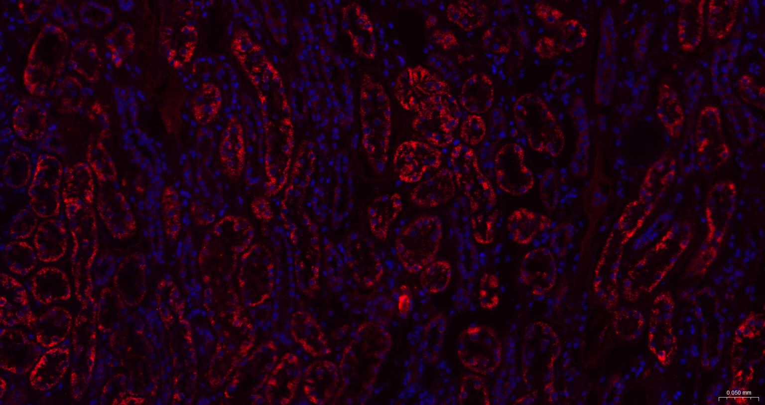 ACAA2重组兔单抗