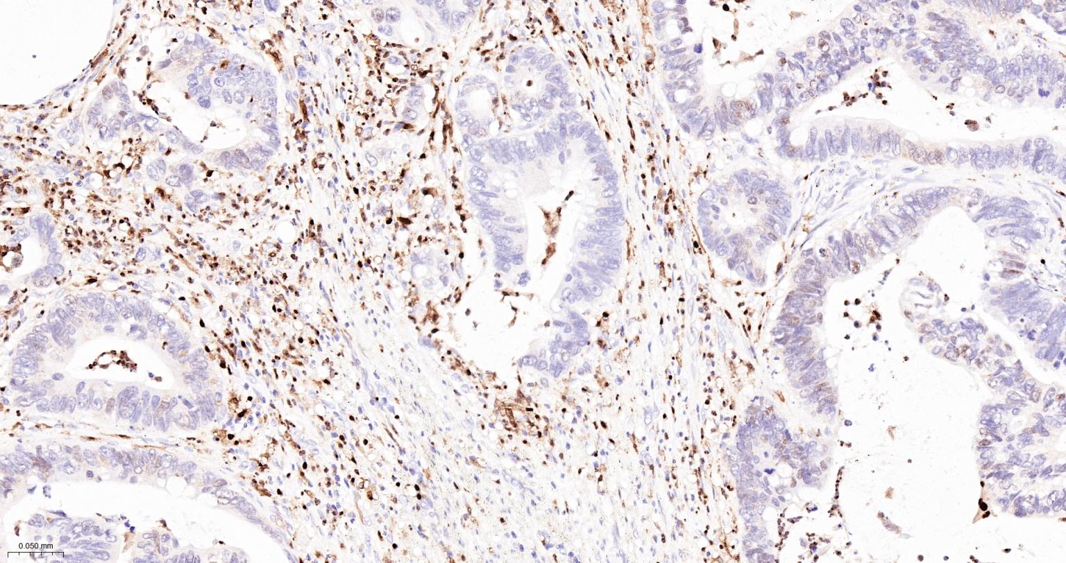 5-脂氧合酶重组兔单抗