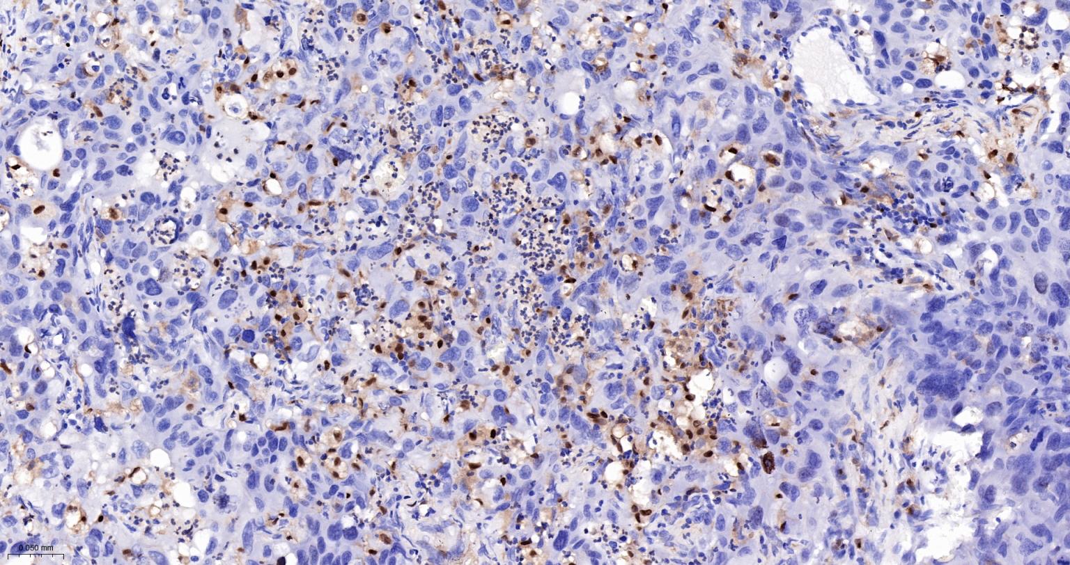 5-脂氧合酶重组兔单抗