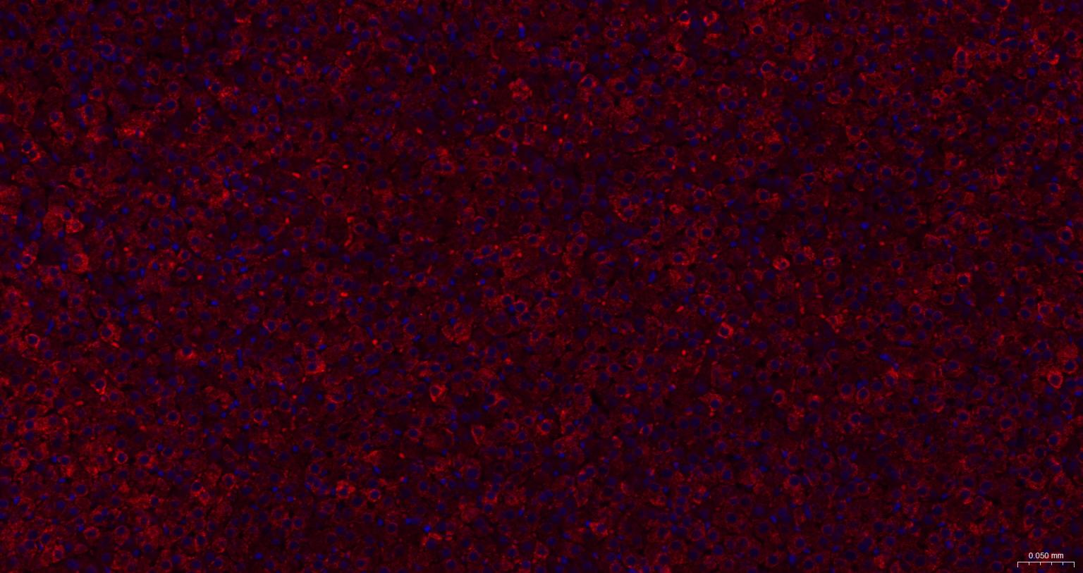 ACAA2重组兔单抗