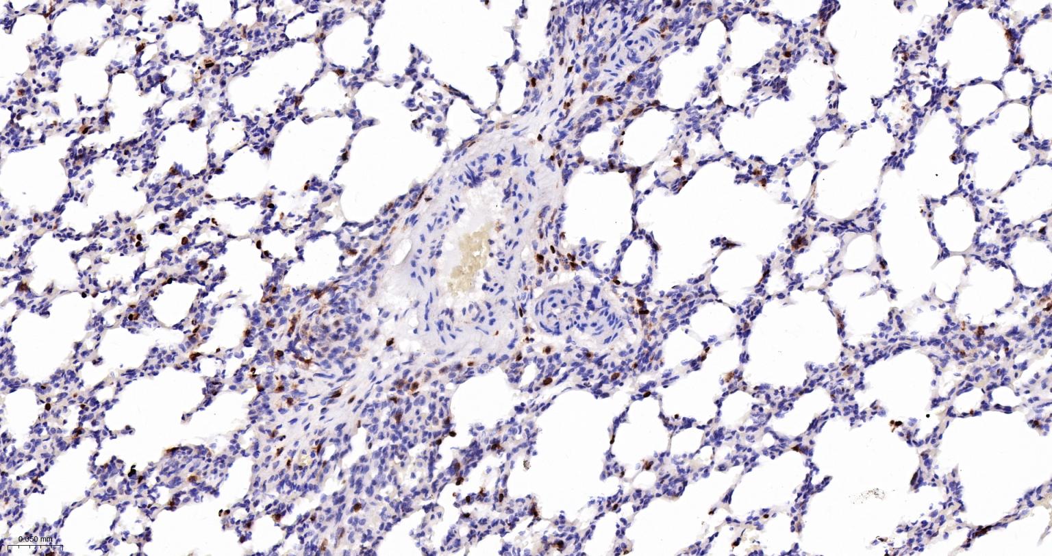 5-脂氧合酶重组兔单抗