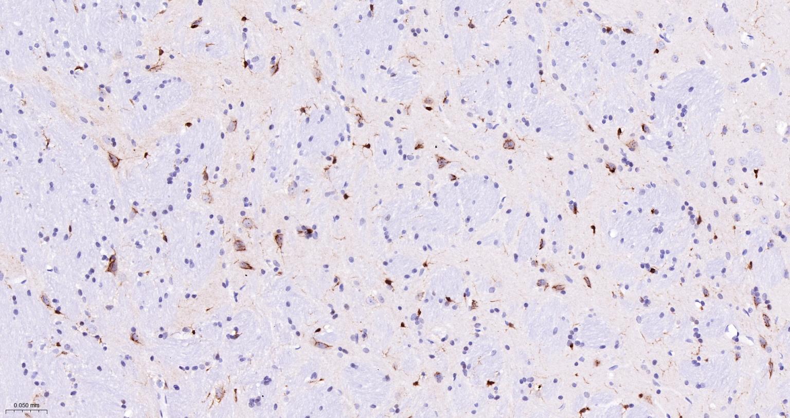 5-脂氧合酶重组兔单抗