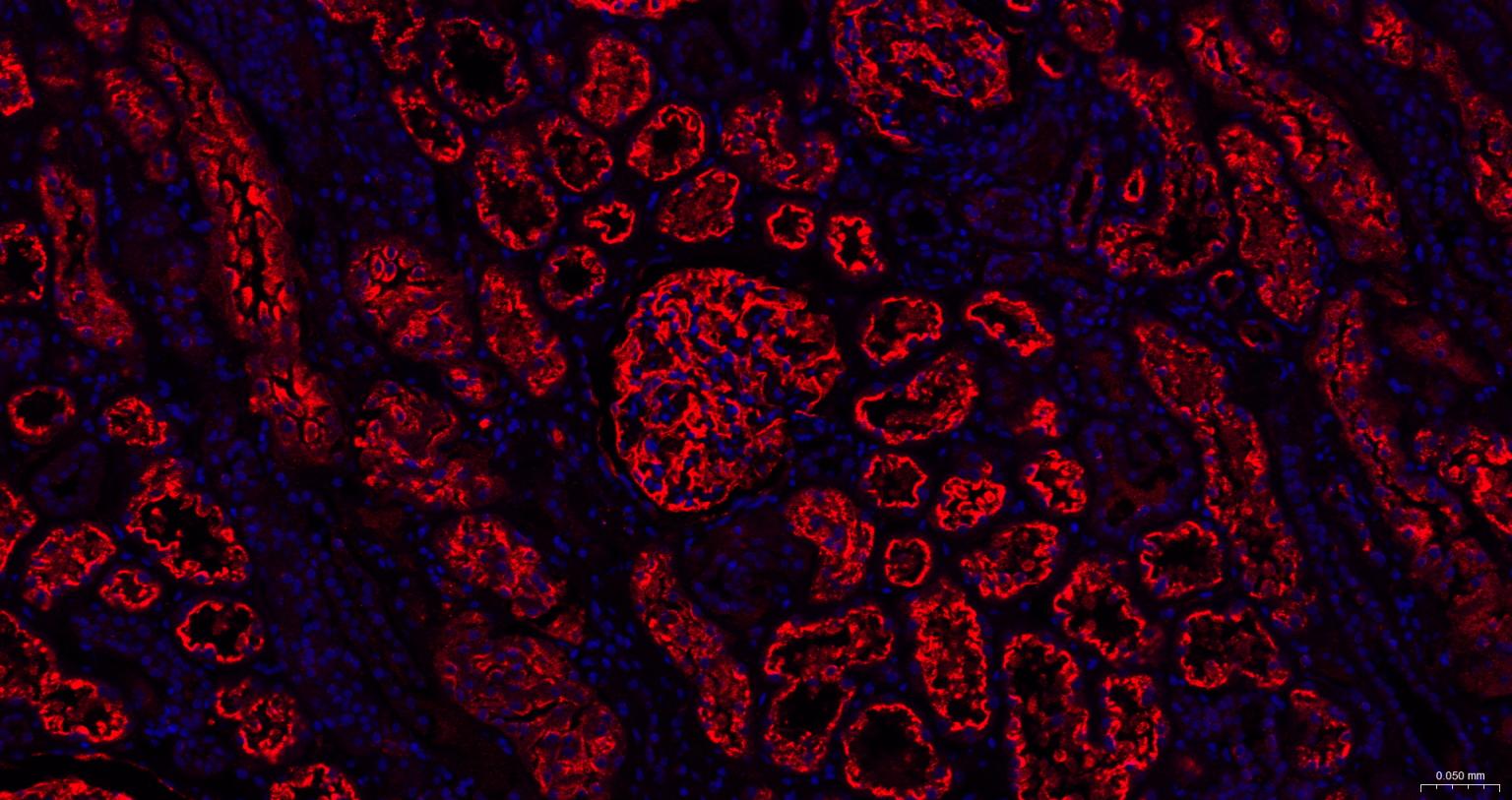 瘦素受体重组兔单抗