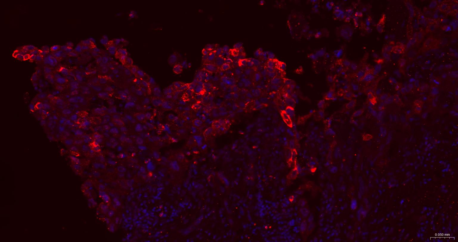 粘蛋白-1单克隆抗体-bsm-41730M