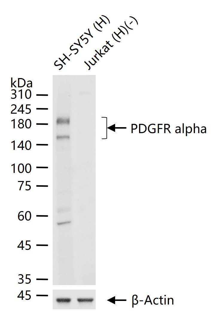 PDGFRα重组兔单抗